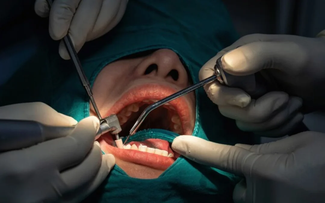 Oral Surgeon: Complete Guide to Oral Surgery and Dental Treatments
