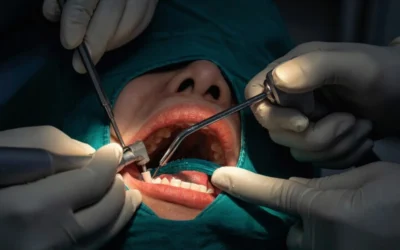 Oral Surgeon: Complete Guide to Oral Surgery and Dental Treatments