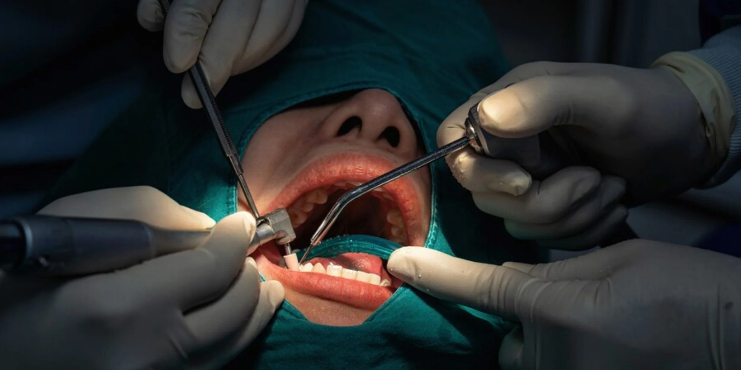 Oral surgeon Oral surgeon